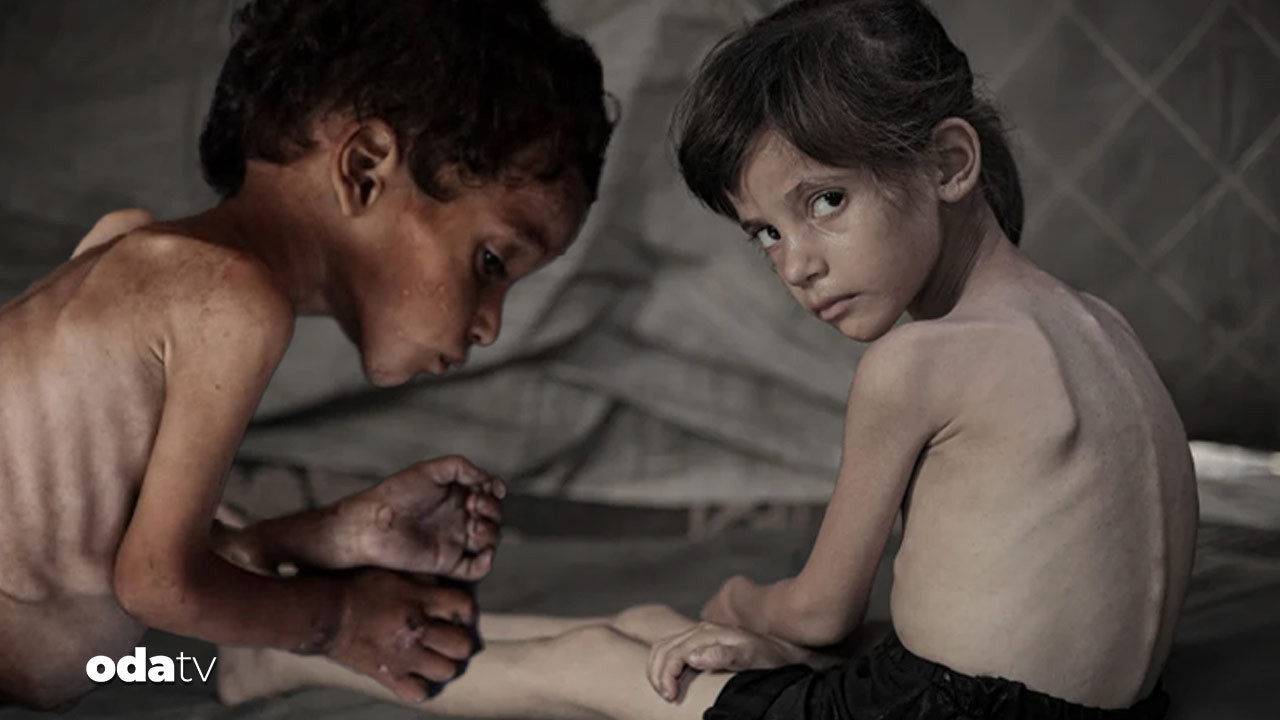 new york times daha fazla dayanamadi gazzede cocuklar acliktan eriyor hayatta kalanlarin gelecegi tehlikede 84XLBrZb